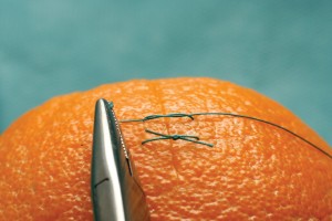 Rui Bang, which distributed medical suture supplies for Johnson & Johnson, lost its case.